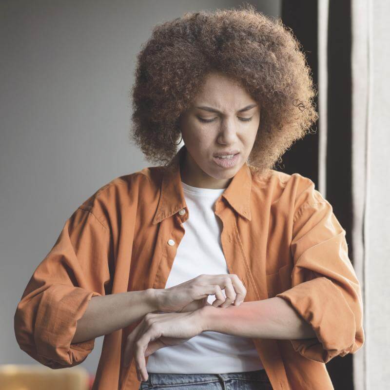 Donna con capelli afro che si gratta l’avambraccio a causa di una reazione allergica cutanea